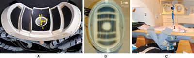 A Novel Concept of a Phased-Array HIFU Transducer Optimized for MR-Guided Hepatic Ablation: Embodiment and First In-Vivo Studies